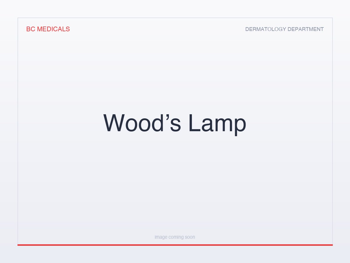 Wood’s Lamp