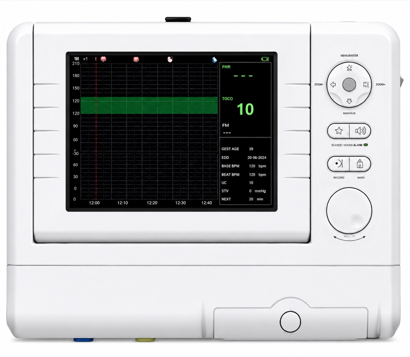 Cardiotocography (CTG) Unit variant