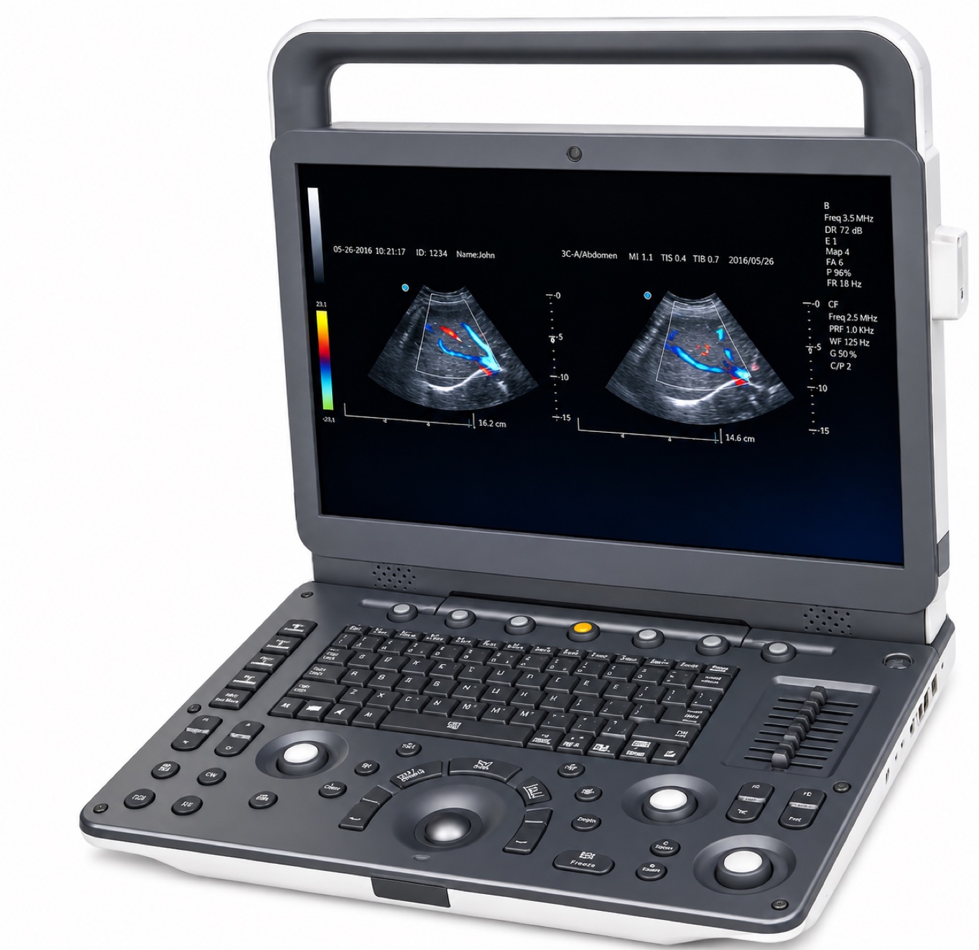 Portable Color Doppler Ultrasonic Diagnostic System variant
