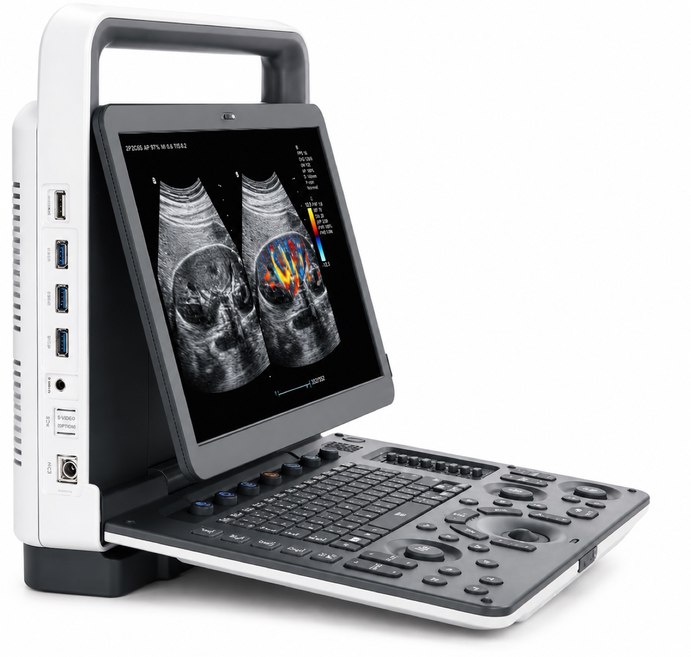 Portable Color Doppler Ultrasonic Diagnostic System variant